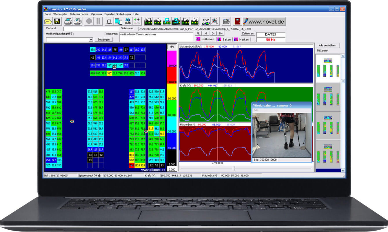 pressure mapping for prosthesis utilizing pliance sensor