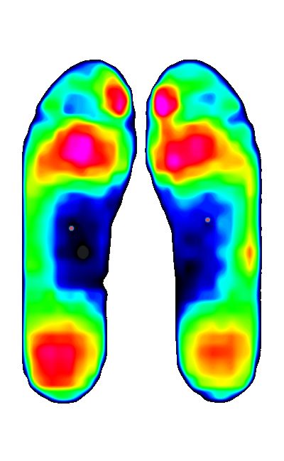 Smooth colour-coded pressure distributions across both feet in novel studio.